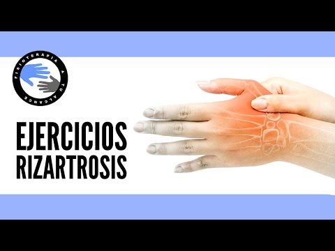 Artrosis De Manos Fisioterapia A Tu Alcance