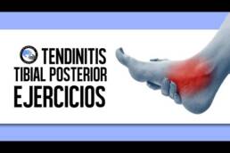 Tendinitis del tibial posterior, tratamiento y ejercicios