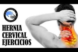 Hernia discal cervical o hernia de disco cervical tratamiento y ejercicios para aliviar el dolor