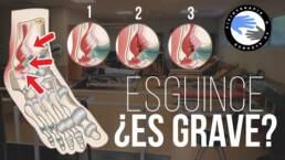 ???????? Como saber si un ESGUINCE de tobillo es GRAVE