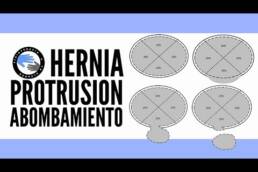 Hernia de disco, protrusion y extrusion discal ¿que son, como diferenciarlas?