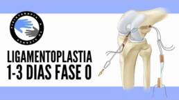 FASE 0: Ligamentoplastia rehabilitacion para la operacion del ligamento cruzado anterior
