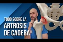 Artrosis de cadera, qué es, por qué se produce, tratamiento y recomendaciones