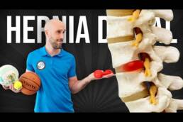 Qué DEPORTES NO hacer con una HERNIA DISCAL