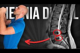 4 EJERCICIOS para HERNIA discal DE PIE