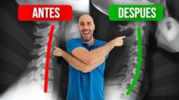 ¡DETEN el DOLOR DE CUELLO! EJERCICIOS para corregir LA RECTIFICACIÓN CERVICAL
