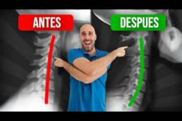 ¡DETEN el DOLOR DE CUELLO! EJERCICIOS para corregir LA RECTIFICACIÓN CERVICAL