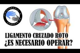 Rotura de ligamentos cruzados, ¿es necesaria la operacion?