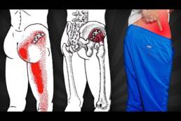 MEJORES EJERCICIOS para tu GLÚTEO MEDIO y PROTEGER tu CADERA