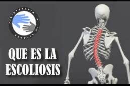 Que es la escoliosis de columna