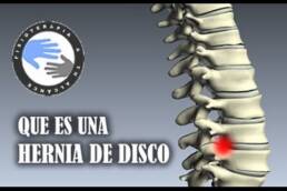 Hernia discal, que es y como se produce