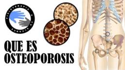 Que es la osteoporosis y porque se produce