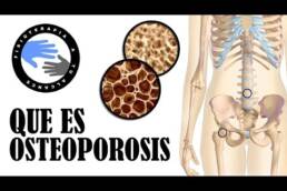 Que es la osteoporosis y porque se produce