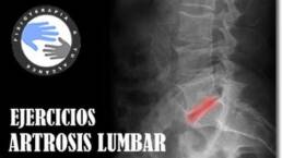 Artrosis de columna lumbar ejercicios