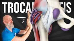 EJERCICIOS para ALIVIAR la TROCANTERITIS