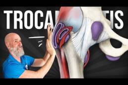 EJERCICIOS para ALIVIAR la TROCANTERITIS