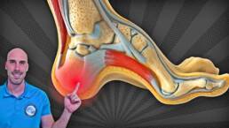 PIE CAVO Y DOLOR DE TALÓN – 3 EJERCICIOS para ALIVIAR la Fascitis Plantar