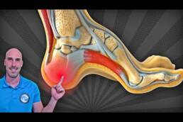 PIE CAVO Y DOLOR DE TALÓN – 3 EJERCICIOS para ALIVIAR la Fascitis Plantar