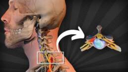 HERNIA CERVICAL: 7 EJERCICIOS para  que CAMBIARÁN tu cuello para SIEMPRE