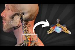 HERNIA CERVICAL: 7 EJERCICIOS para  que CAMBIARÁN tu cuello para SIEMPRE