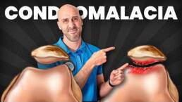 5 EJERCICIOS CLAVE para FRENAR la CONDROMALACIA y ELIMINAR el DOLOR de RODILLA