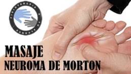 Neuroma de Morton tratamiento y fisioterapia