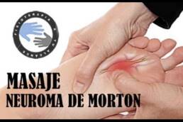 Neuroma de Morton tratamiento y fisioterapia