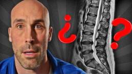 HERNIA DISCAL: lo que NADIE te explica de tu RESONANCIA