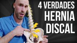 4 COSAS que no sabias sobre las HERNIAS DISCALES