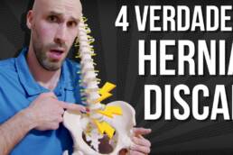 4 COSAS que no sabias sobre las HERNIAS DISCALES