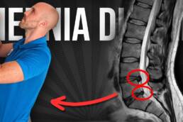 4 EJERCICIOS para HERNIA discal DE PIE