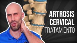 ARTROSIS CERVICAL, ejercicios, masaje y estiramientos para ALIVIAR EL DOLOR