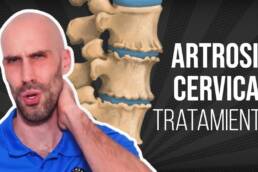 ARTROSIS CERVICAL, ejercicios, masaje y estiramientos para ALIVIAR EL DOLOR