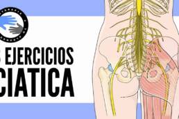 Alivia AL INSTANTE la ciatica por hernia discal