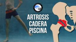 Artrosis de cadera rutina de ejercicios en piscina