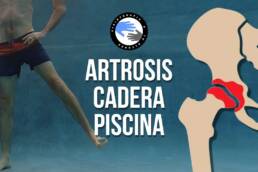 Artrosis de cadera rutina de ejercicios en piscina