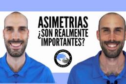 Asimetrias musculares, porque no debes darles importancia