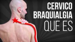 CERVICOBRAQUIALGIA, que es, por que se produce, y cual es su TRATAMIENTO