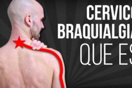CERVICOBRAQUIALGIA, que es, por que se produce, y cual es su TRATAMIENTO