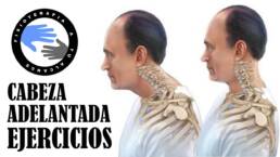 Cabeza adelantada, ejercicios para mejorar la postura o sindrome cruzado superior