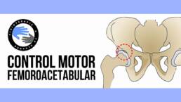 Choque femoroacetabular, 10 ejercicios para mejorar el control motor y aliviar el dolor