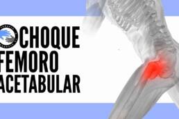Choque femoroacetabular 5 ejercicios que te ayudaran a mejorar la movilidad y el dolor de cadera