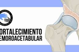 Choque femoroacetabular, 8 ejercicios para fortalecer la cadera y aliviar el dolor
