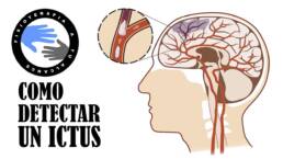Como detectar un ictus o acv en menos de un minuto