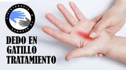 Dedo en gatillo o resorte, fisioterapia, tratamiento y ejercicios