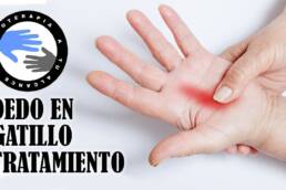 Dedo en gatillo o resorte, fisioterapia, tratamiento y ejercicios