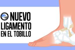 Descubren un nuevo ligamento en el tobillo que explica el esguince de tobillo cronico
