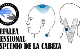 Dolor de cabeza, masaje del musculo esplenio de la cabeza para la cefalea tensional