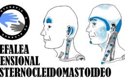 Dolor de cabeza, masaje del musculo esternocleidomastoideo o ECM para la cefalea tensional
