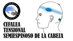 Dolor de cabeza,  masaje del musculo semiespinoso de la cabeza para la cefalea tensional